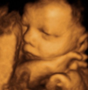 4D ultrasound photo of unborn child